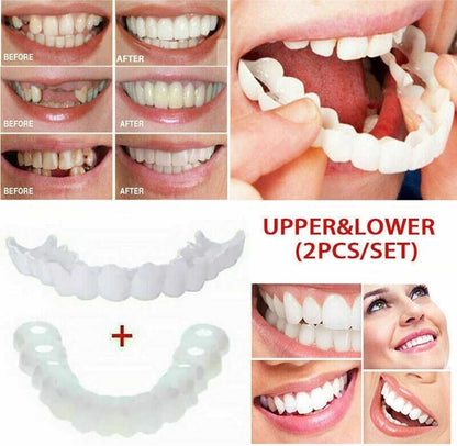 Flexible Snap-In Teeth – Comfortable Cosmetic Teeth Veneers for Men & Women